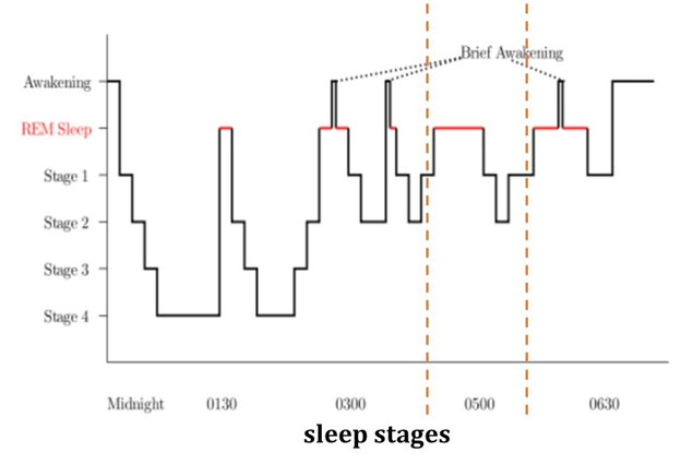 Denholm Aspy/Transitional Experiences:Hypnagogia and Sleep Paralysisより